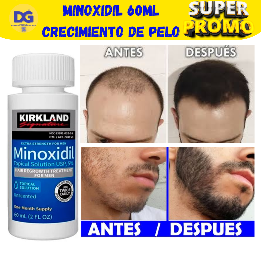 Descubre el Secreto para Combatir la Calvicie de Forma Efectiva (Minoxidil KIRKLANDS 5%)60ML